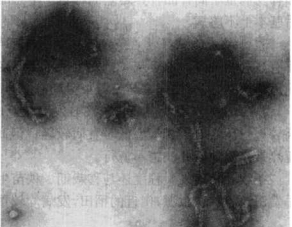 水稻條紋葉枯病的病原物